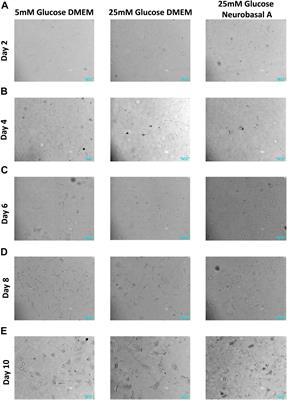 Adult Goat Retinal Neuronal Culture: Applications in Modeling Hyperglycemia